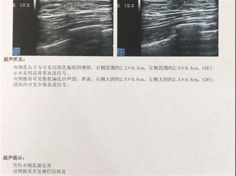 b超报告上的图怎么看
