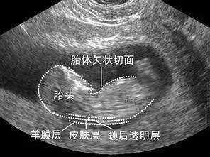 孕14周胎儿发育到什么程度