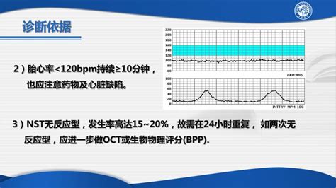 胎心监护率160持续10分钟