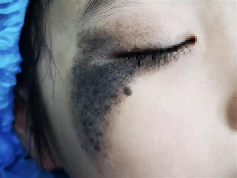 四个月宝宝脸上皮肤黑