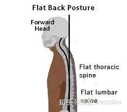 膝胸卧位纠正方法图解