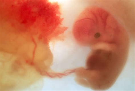 胎儿的心脏何时发育成熟