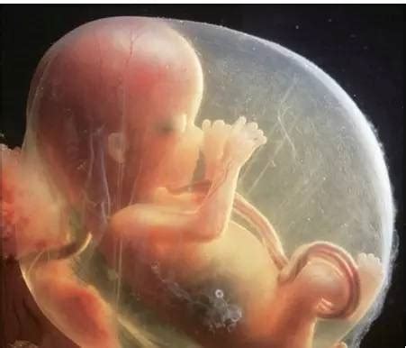 多次胚胎停育的原因