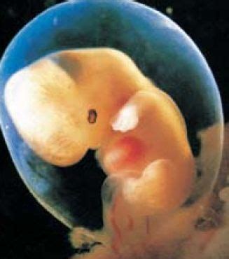 8周胎儿多大图