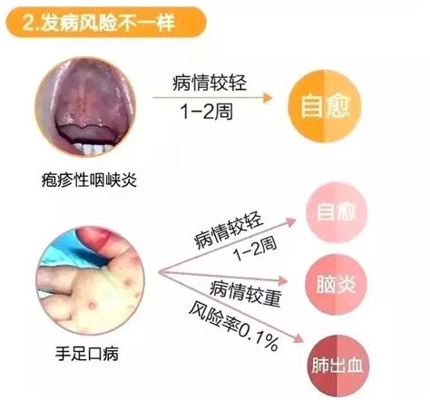 春季如何预防手足口病