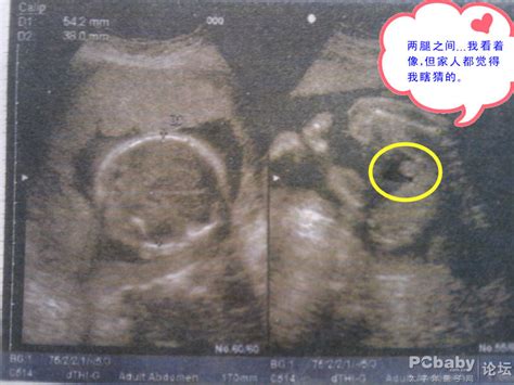 五个月以后胎儿彩超图片