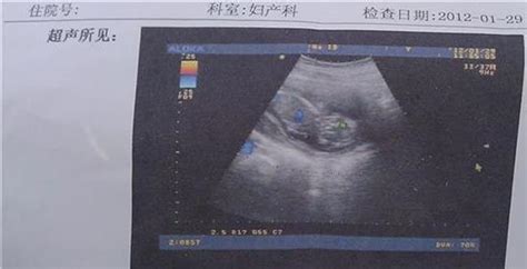 6个月大的胎宝宝发育的样子