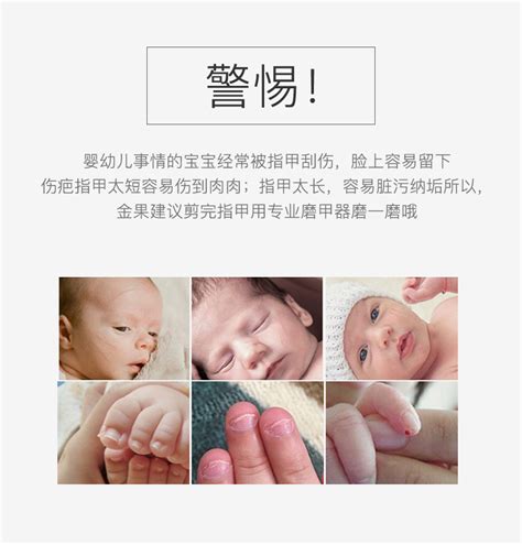 有甲减或甲亢可以喂宝宝母乳吗