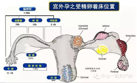 孕5周可以查出宫内宫外了吗