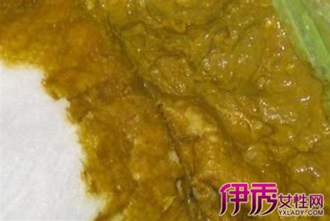 孕40周羊水浑浊是什么原因造成的