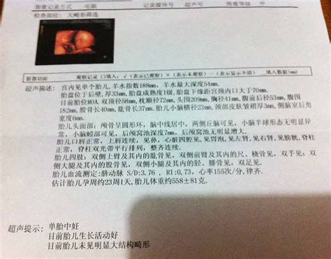 孕39周胎心120正常吗