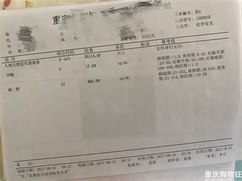 孕检重要吗