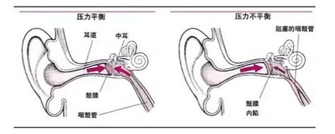 分泌性中耳炎用欧龙马是首选吗