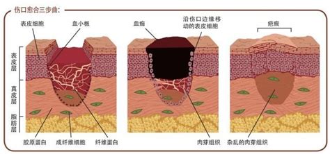 怀孕后哪些部位会变黑