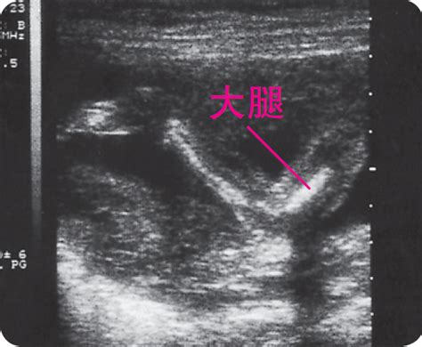 怀孕6周胎儿的发育标准