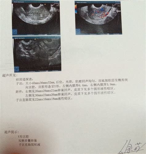 排卵了为什么没有怀孕