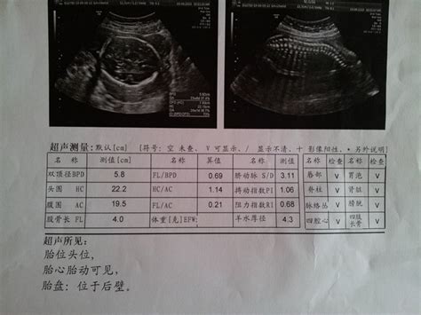 9周的胎儿b超图