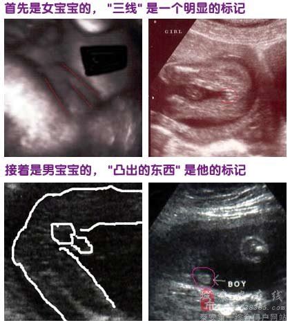 怀孕六个月的胎儿图片