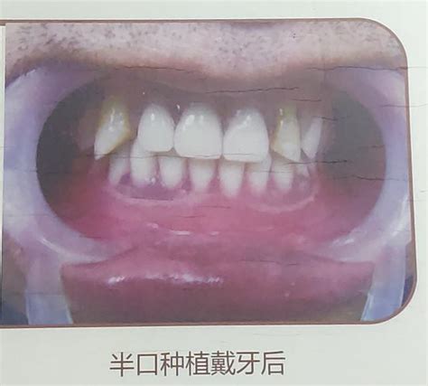 2021年广州口腔种植牙招聘