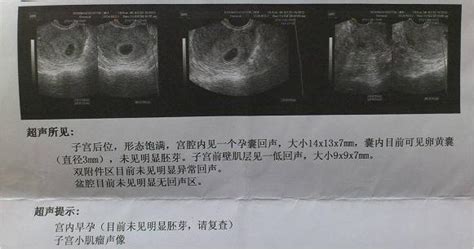 怀孕5到6周打b超看得见吗