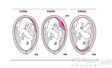 孕10周测胎心位置