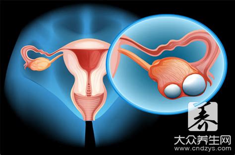 妇科常规检查可以查出卵巢癌吗