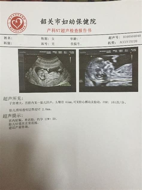 男孩胎囊图片 形状