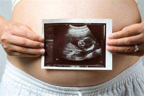 胎儿脐带绕颈，孕妈能做些什么来改善