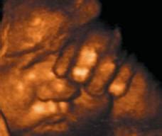 十月怀胎胎儿发育过程