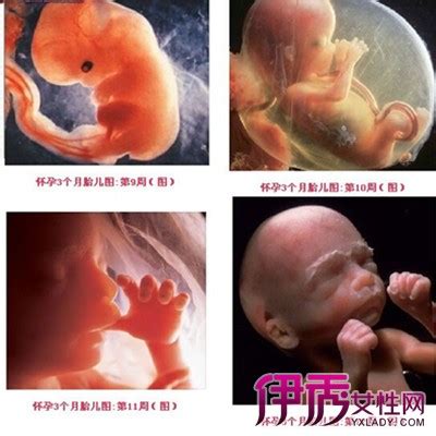 怀孕三个多月胎儿图片
