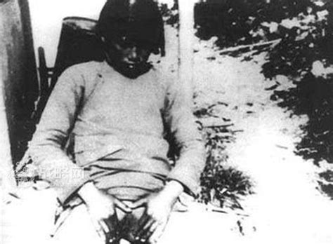 乳房偶尔针扎一样疼一下