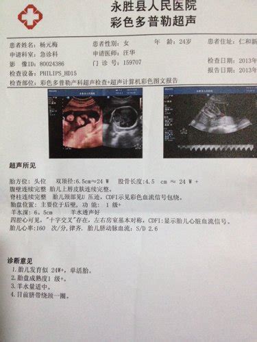 32周臀位脐带绕颈一周了怎么办