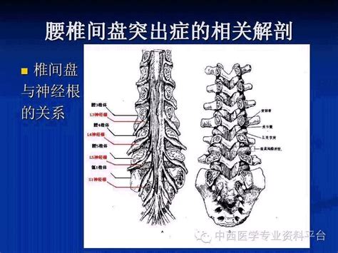 三伏贴可以治疗腰椎盘突出吗