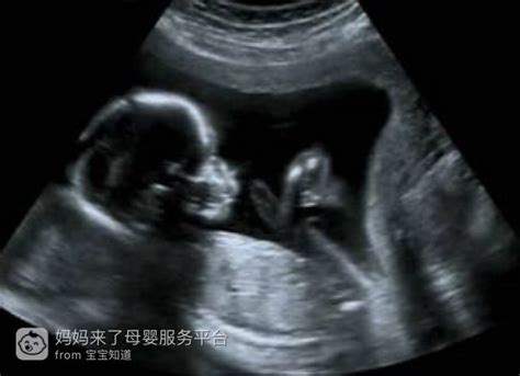 b超图像左右怎么看