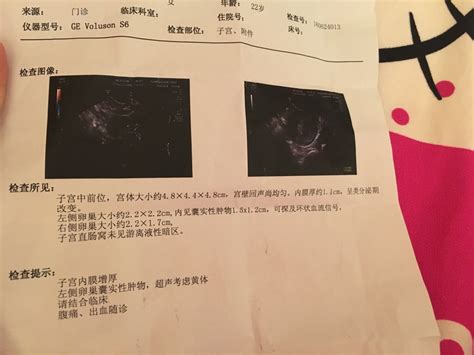 早孕49天流血有血块
