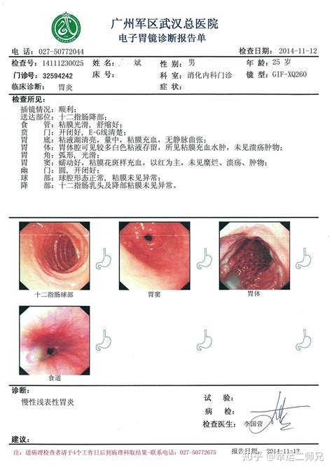 胃病最神奇的偏方