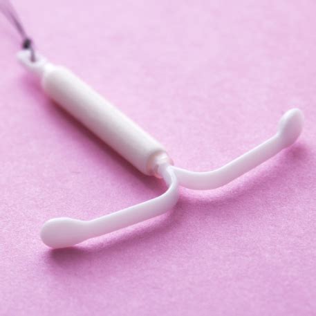 避孕环有副作用吗