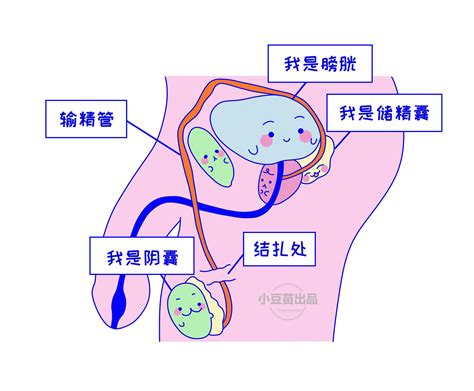 清宫手术打全麻还是局部麻醉
