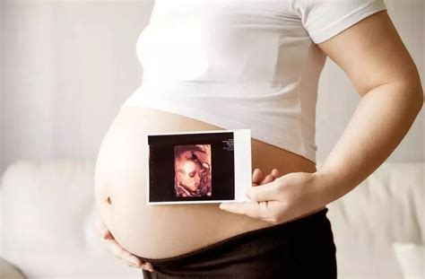 怀孕先检查三维还是四维