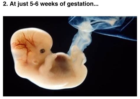 三个月胎儿胎心率155次