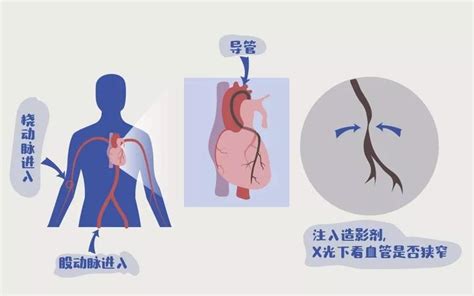 用了按摩器后的副作用