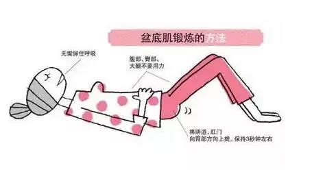 盆底肌修复最佳时间已过