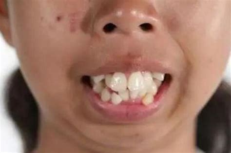 胎位不正是什么原因导致的