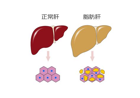 为什么会导致胎位不正呢