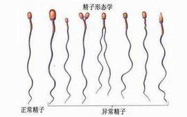 精子畸形会造成胎儿畸形吗