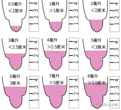 是怎么引起的精子不液化