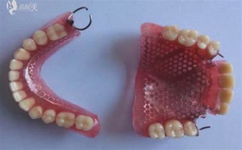 哪里可以修复假牙