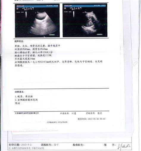 孕中期b超医生如何看孕周
