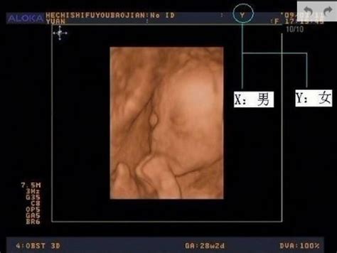 孕囊大小与胎儿发育对照表