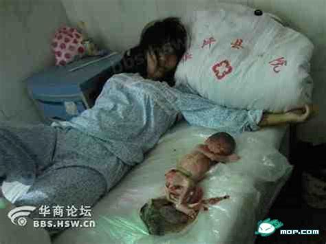 引产后好怀孕吗